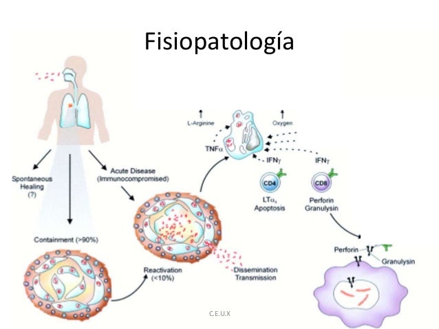 tuberculosis pulmonar fisiopatologia
